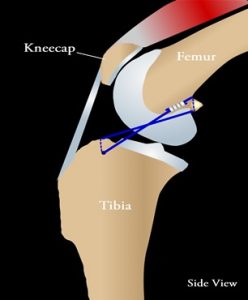 ACL/Cruciate Repair in Abbotsford, BC | Allwest Animal Hospital